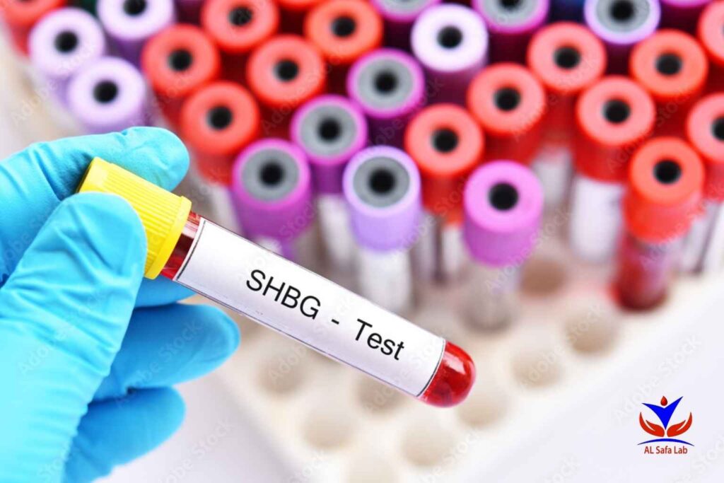 Sex hormone binding globulin (SHBG) test