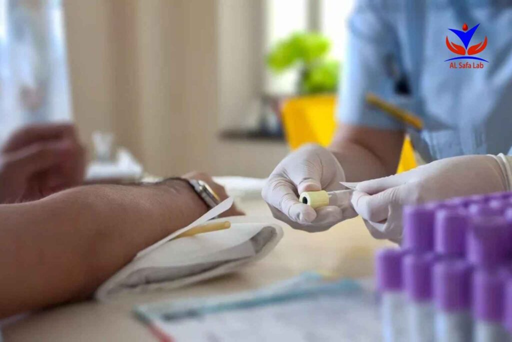 Sex hormone binding globulin (SHBG) test