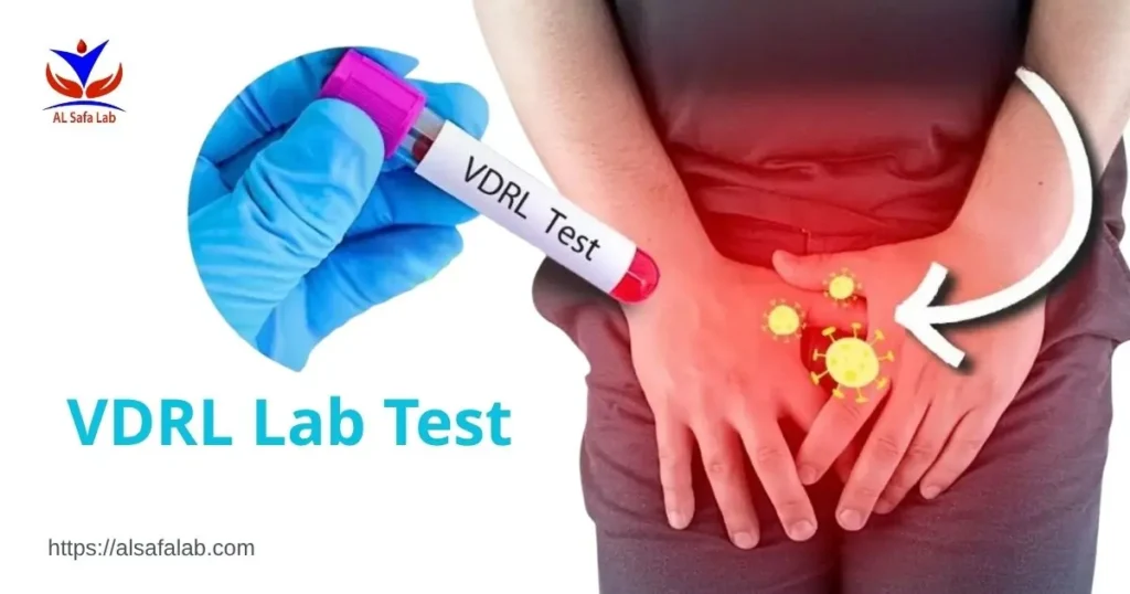 VDRL Lab Test