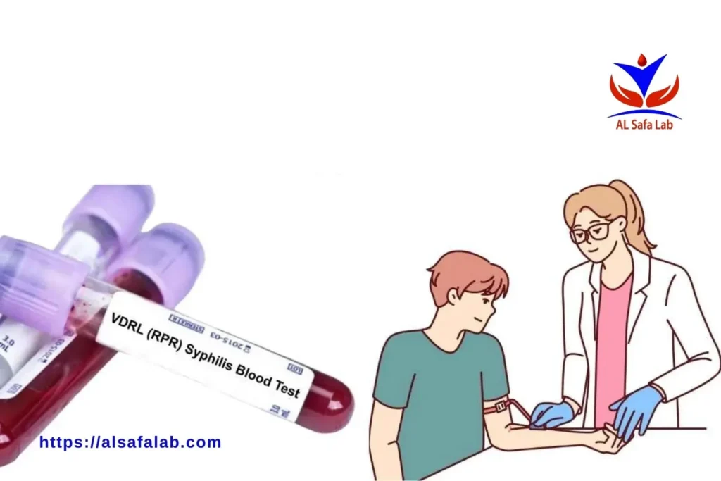 VDRL Lab Test