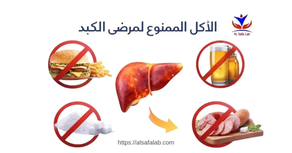 الأكل الممنوع لمرضى الكبد