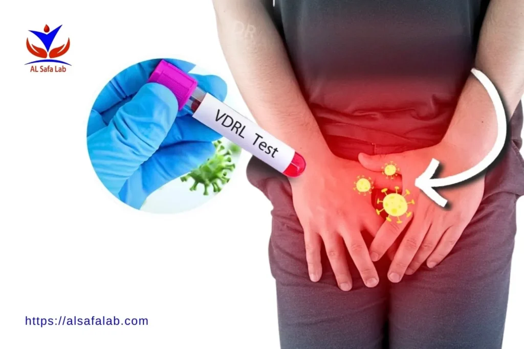 تحليل VDRL