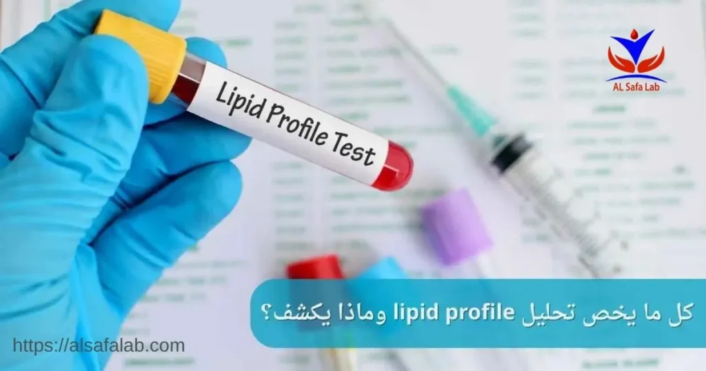 تحليل lipid profile