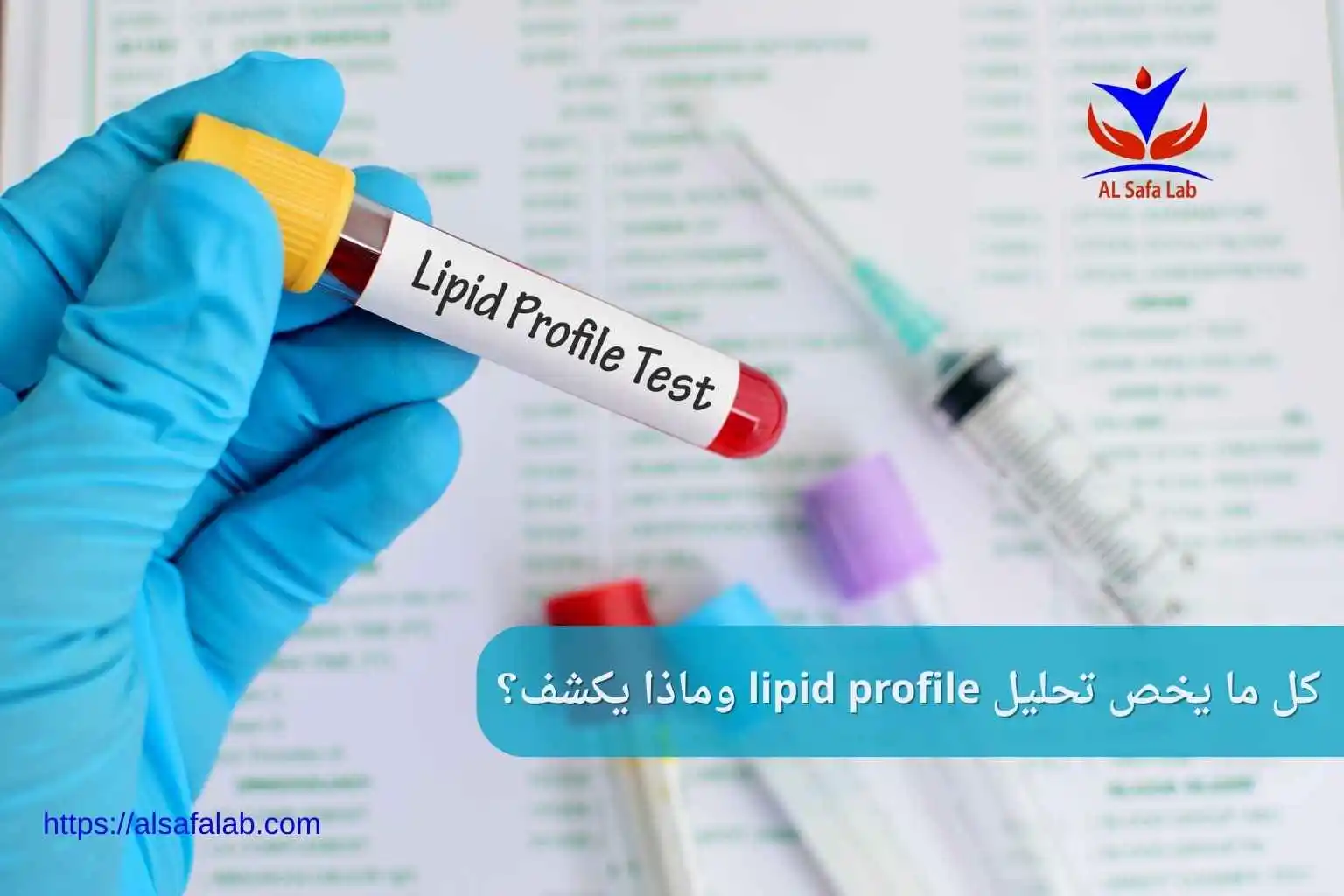 تحليل lipid profile