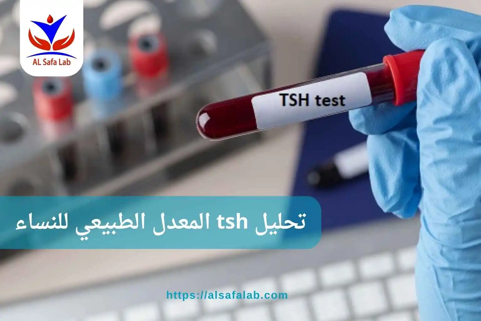 تحليل tsh المعدل الطبيعي للنساء
