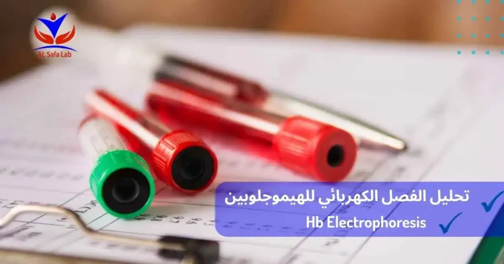 تحليل الفصل الكهربائي للهيموجلوبين
