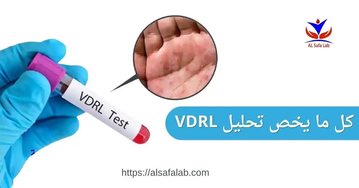 ما هو تحليل VDRL