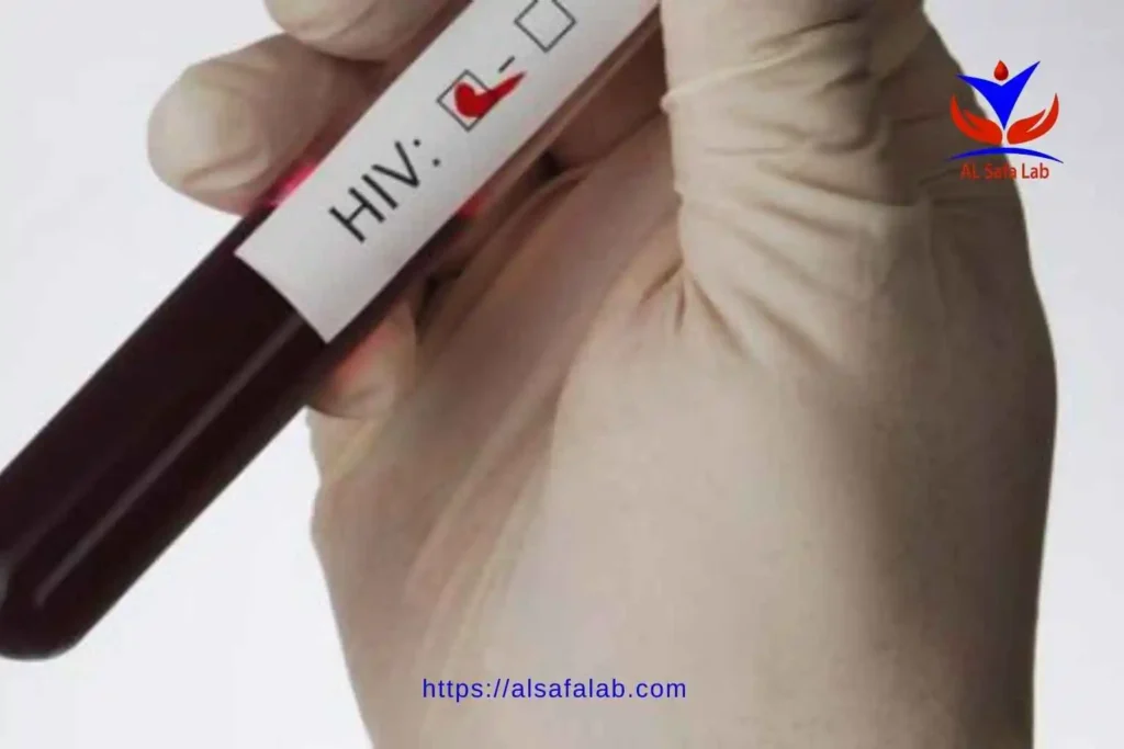 هل تحليل vdrl يكشف الايدز 