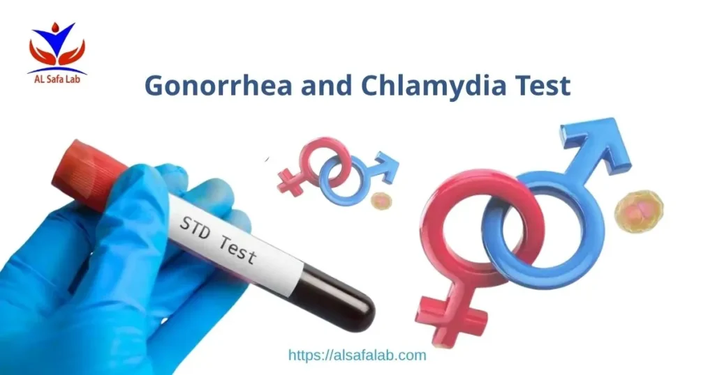 Gonorrhea and Chlamydia Test