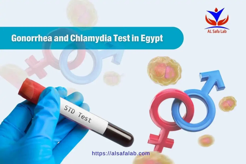 Gonorrhea and Chlamydia Test