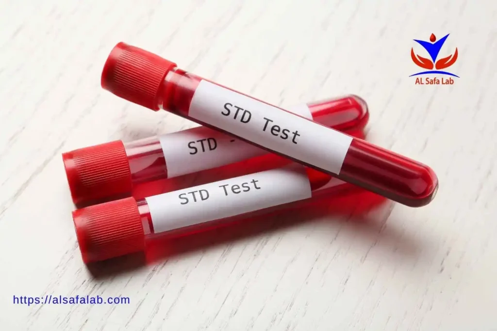 Gonorrhea and Chlamydia Test