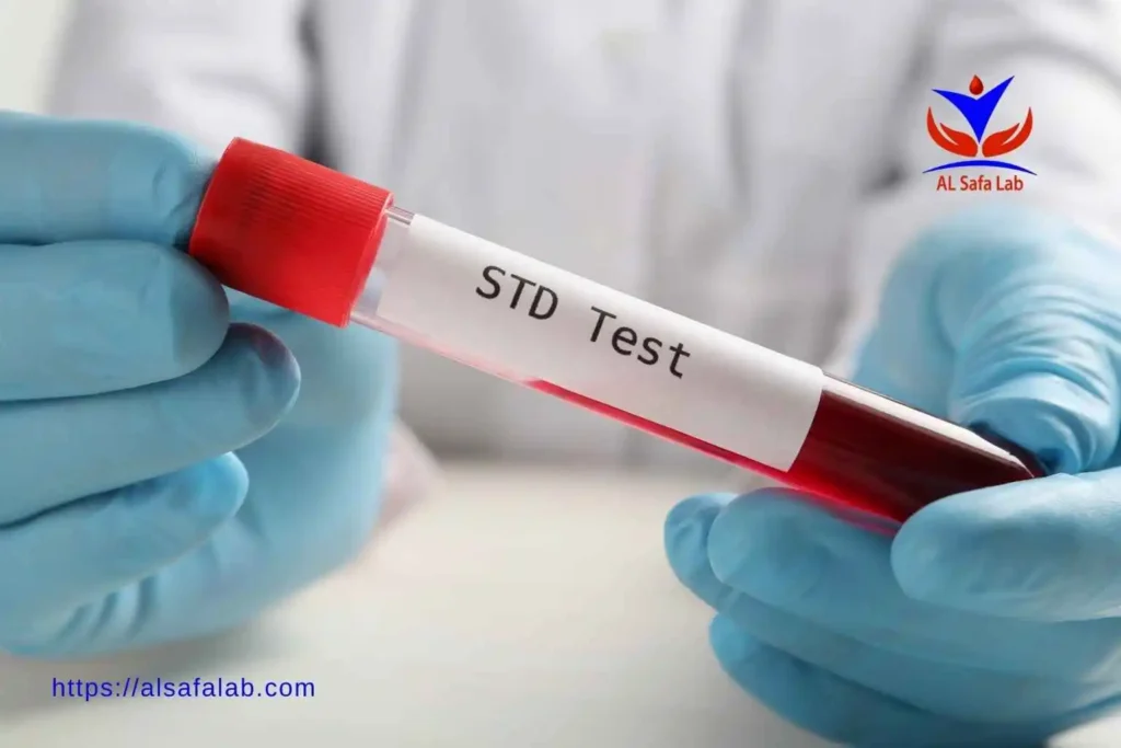 Gonorrhea and Chlamydia Test
