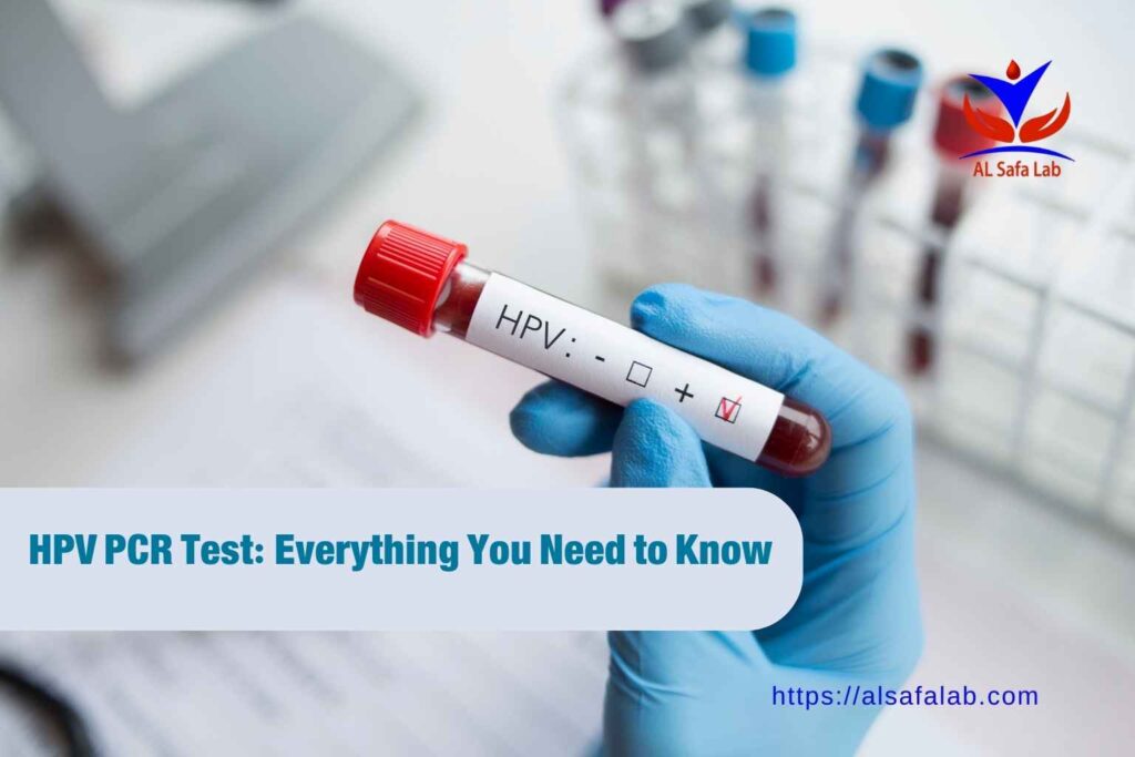 HPV PCR test