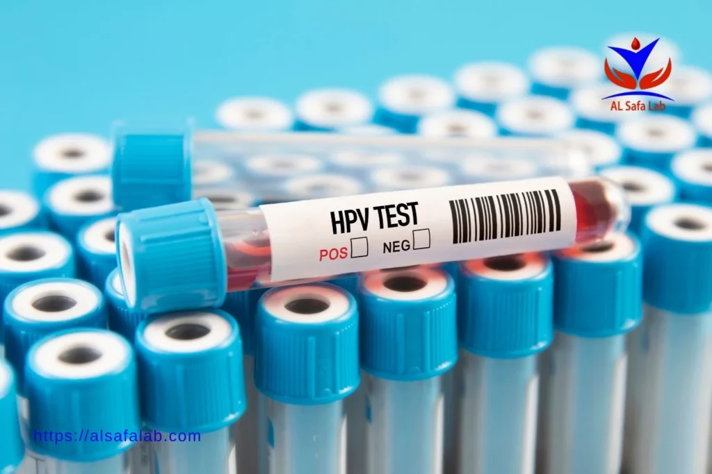 HPV PCR test