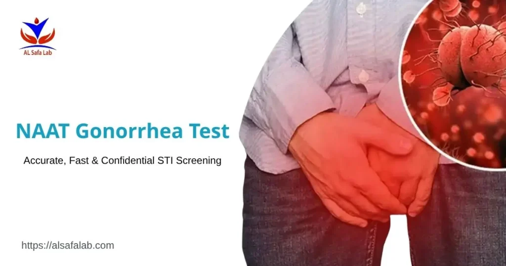 NAAT Gonorrhea Test