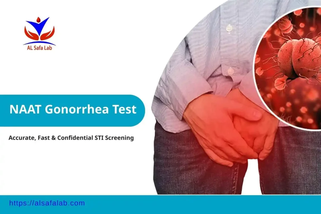NAAT Gonorrhea Test