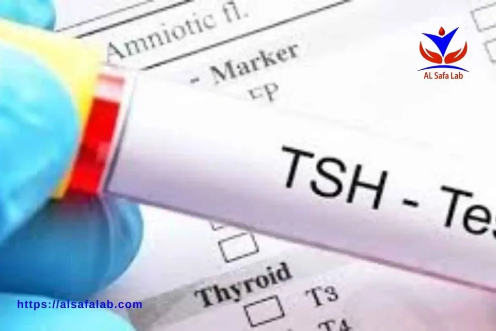 TSH Blood Test