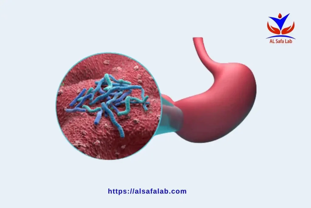 النسبة الطبيعية لجرثومة المعدة بالنفخ