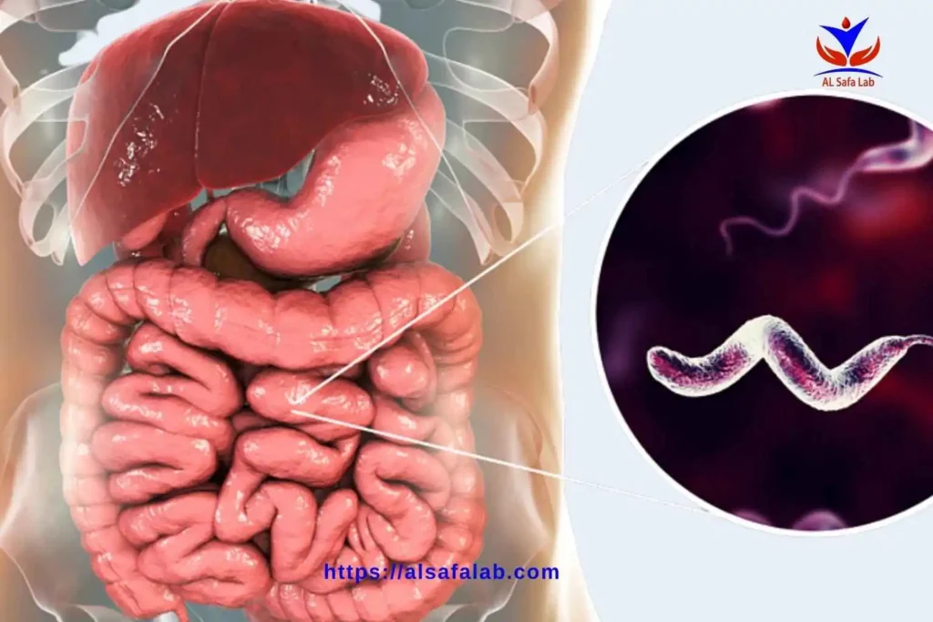 النسبة الطبيعية لجرثومة المعدة بالنفخ