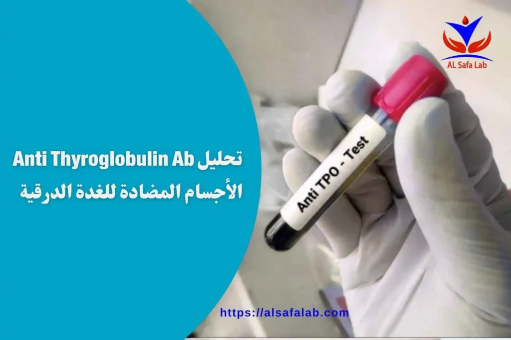 تحليل Anti Thyroglobulin Ab