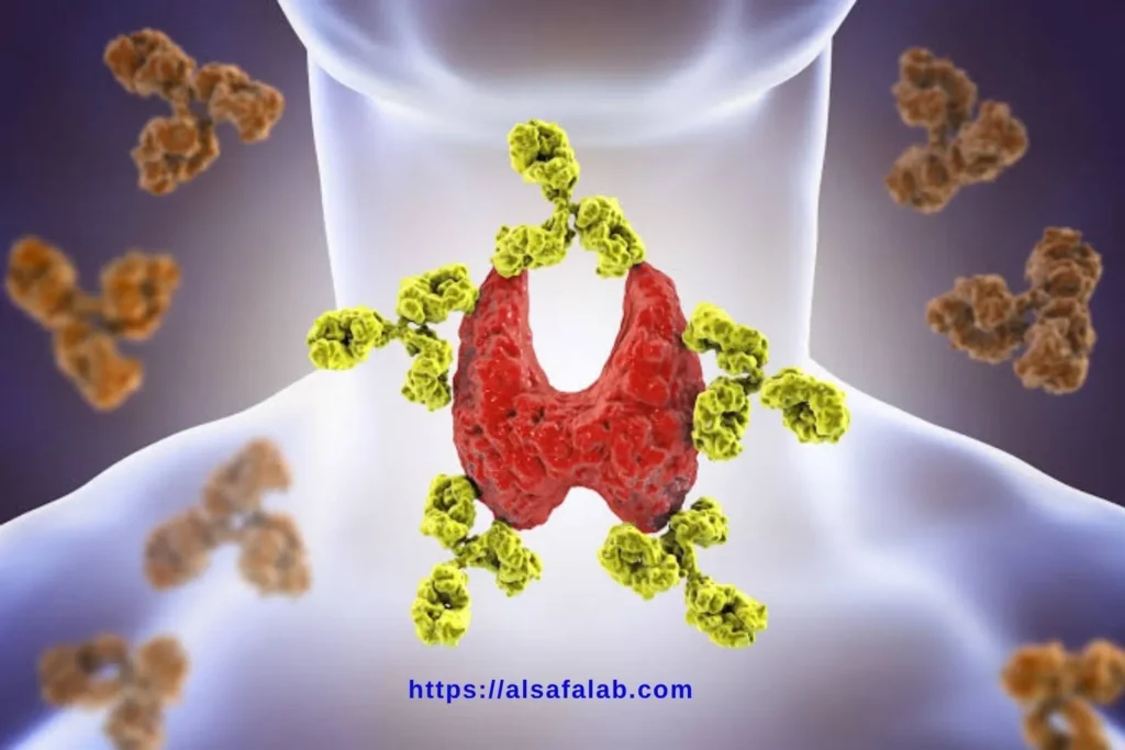 تحليل Anti Thyroglobulin Ab