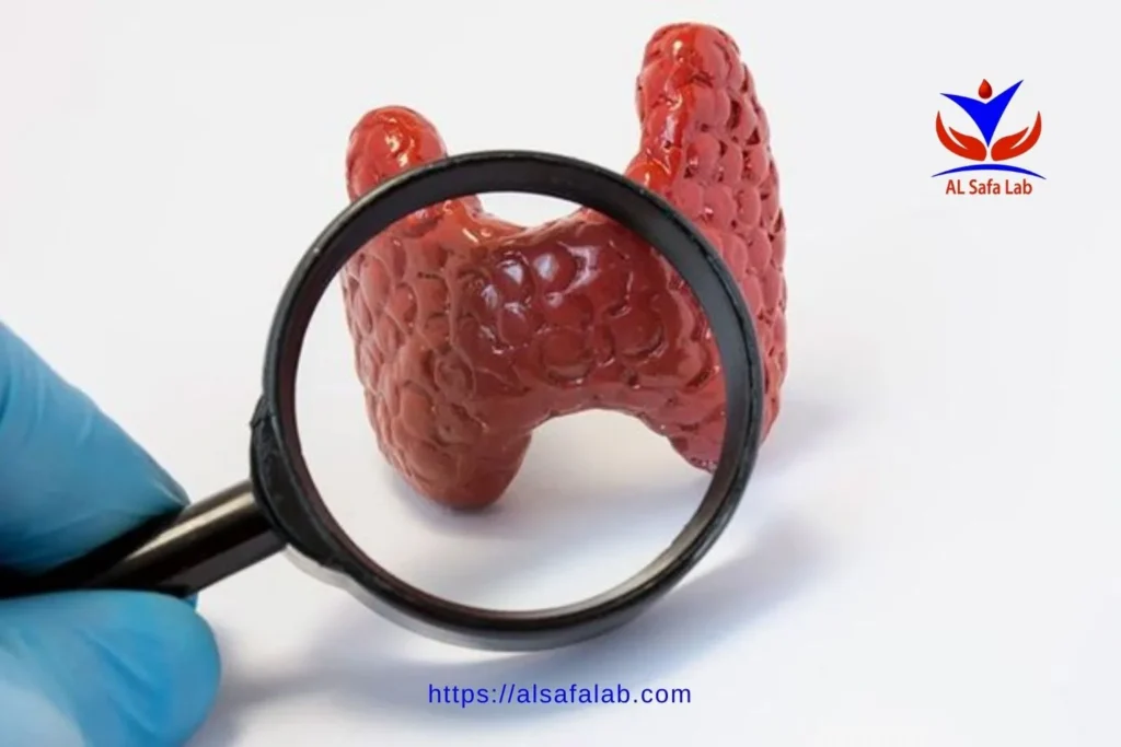 تحليل tsh in serum