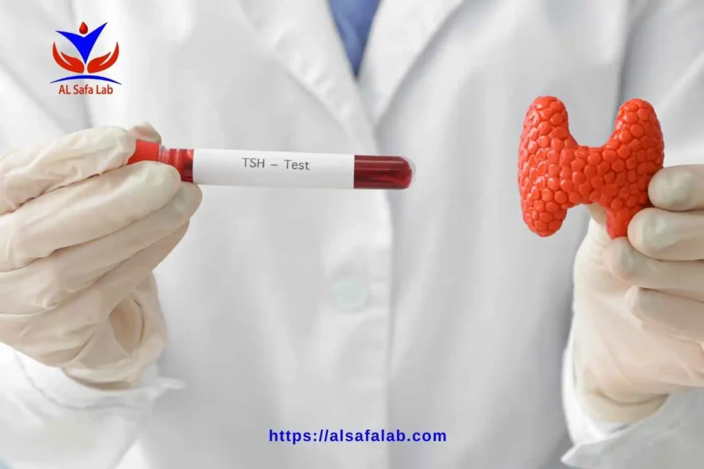 تحليل tsh in serum