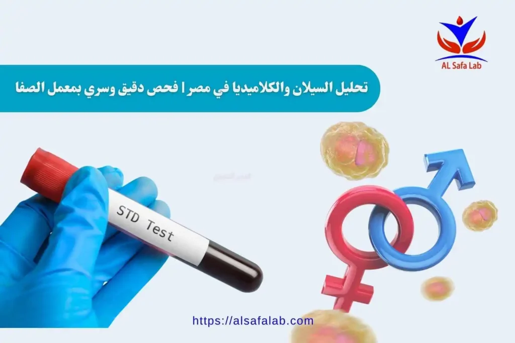 تحليل السيلان والكلاميديا