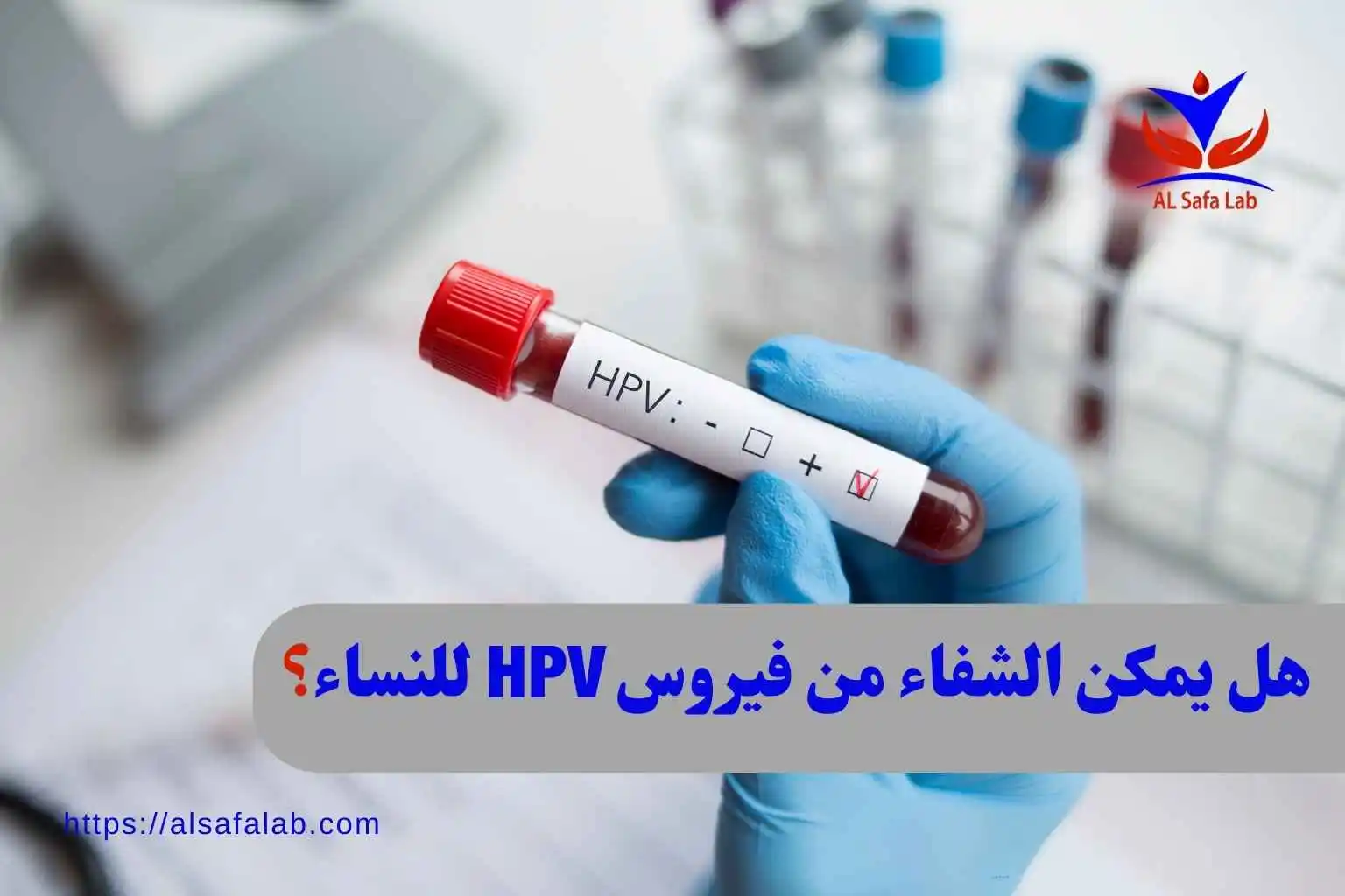 هل يمكن الشفاء من فيروس HPV للنساء