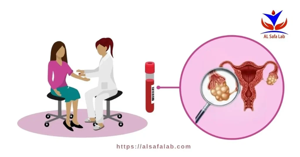 PCOS Tests