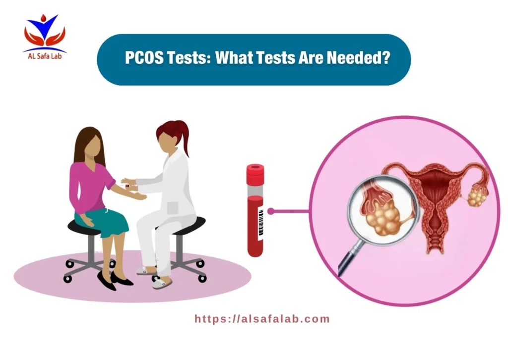PCOS Tests