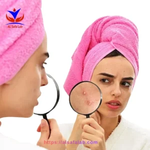 Roaccutane Test Package