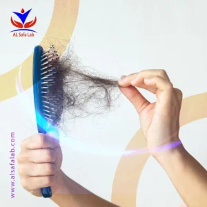 فحوصات تساقط الشعر