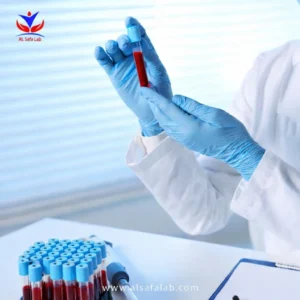 باقة فحوصات سيولة الدم