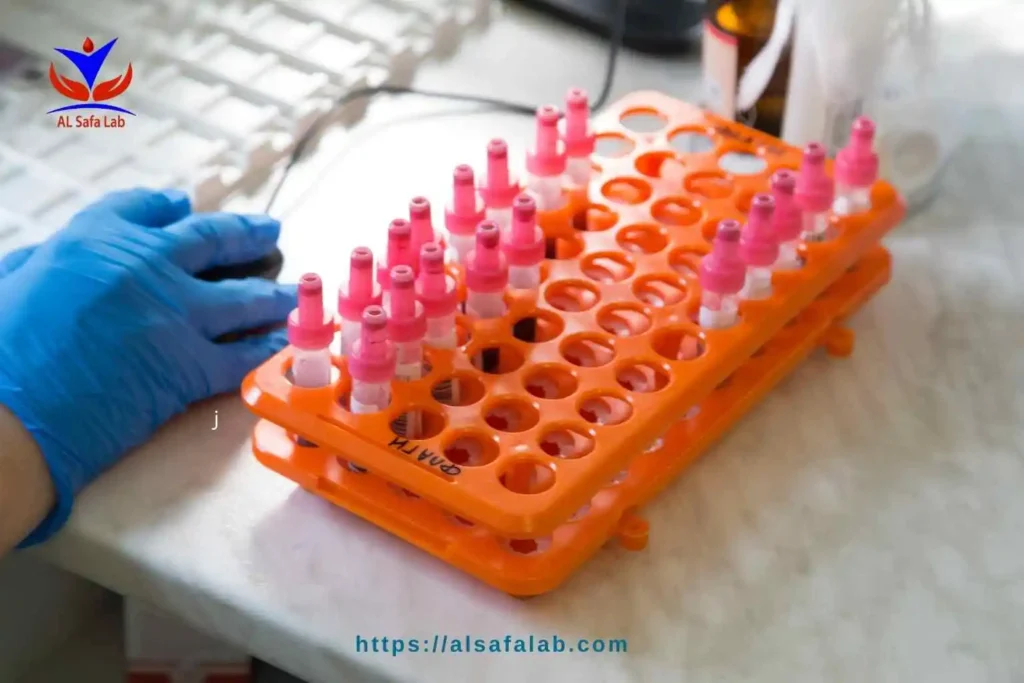 تحاليل التكيسات