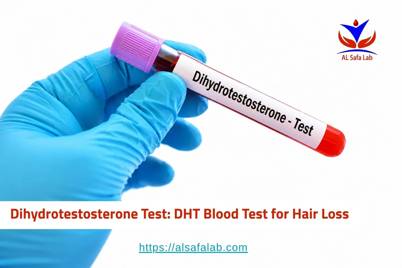 Dihydrotestosterone Test