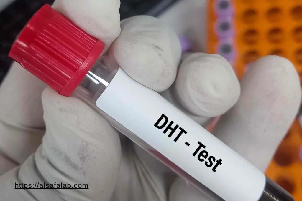 Dihydrotestosterone Test