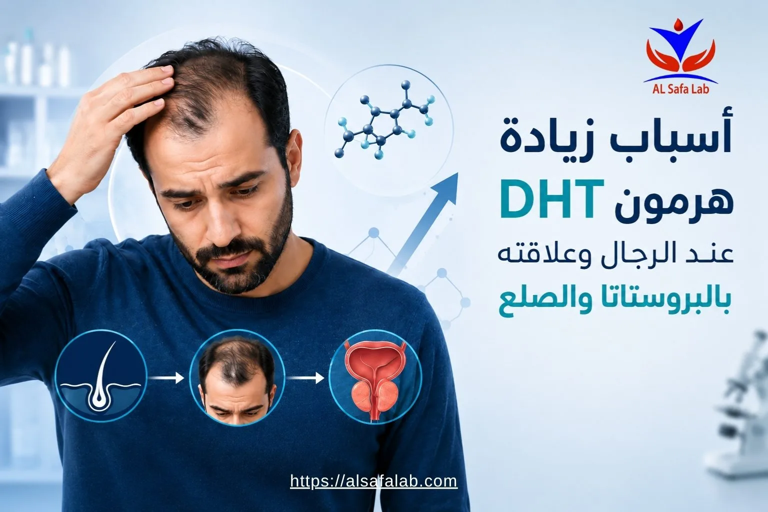 أسباب زيادة هرمون DHT عند الرجال