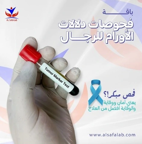 باقة فحوصات دلالات الأورام للرجال