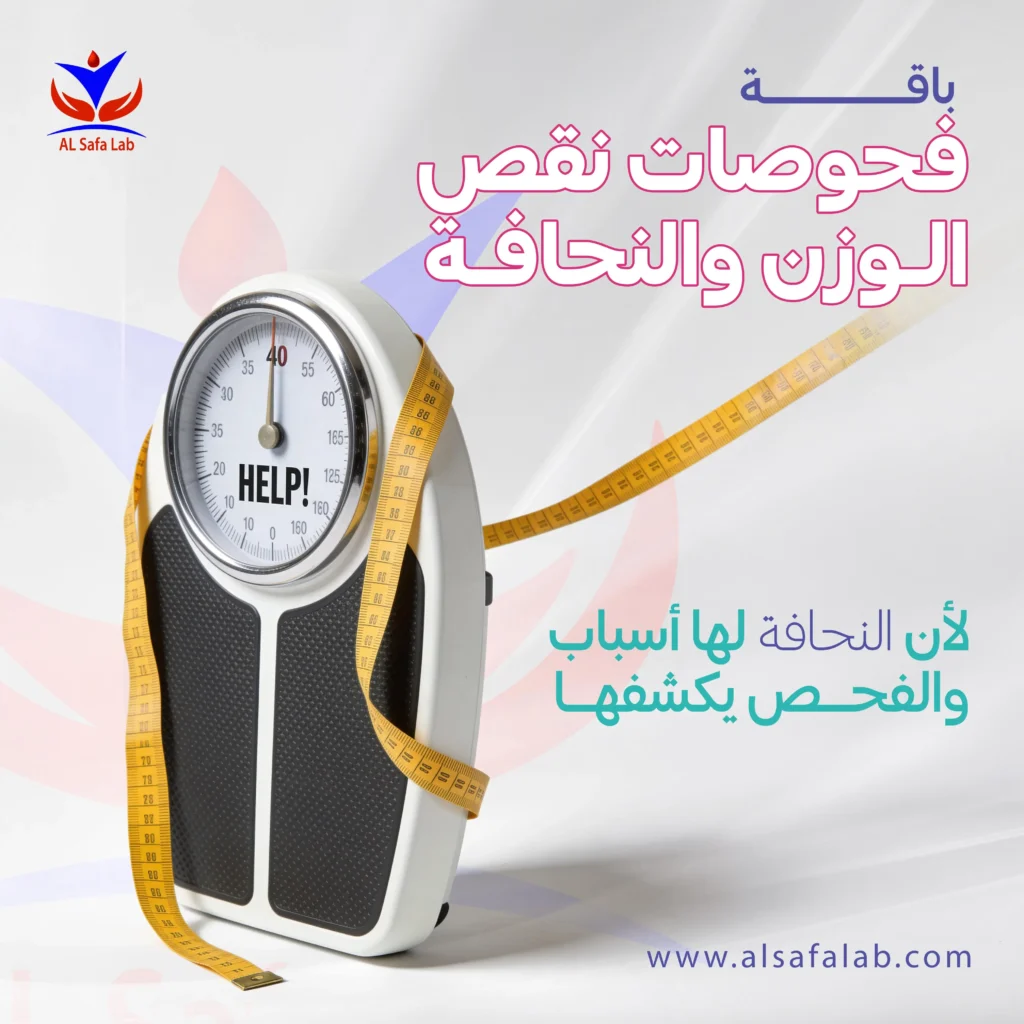 فحوصات نقص الوزن