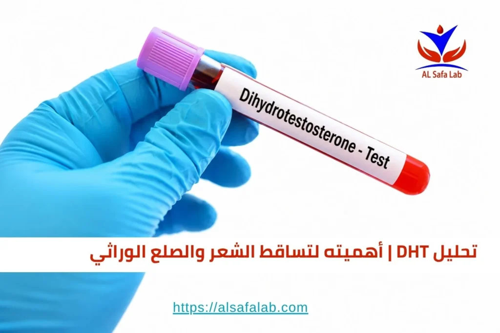 تحليل DHT