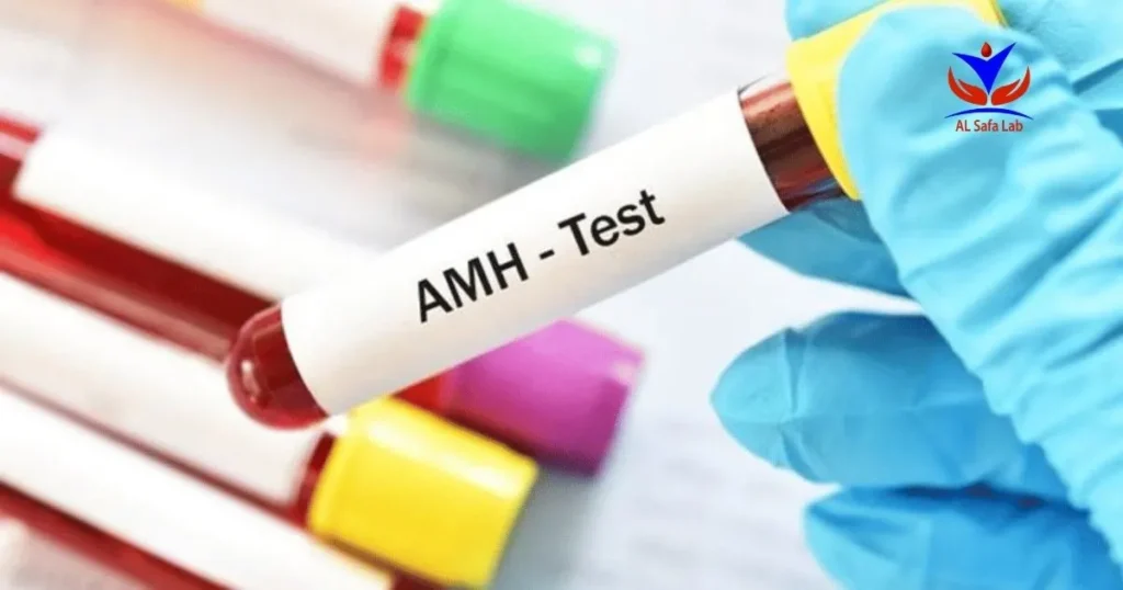 Anti Mullerian Test