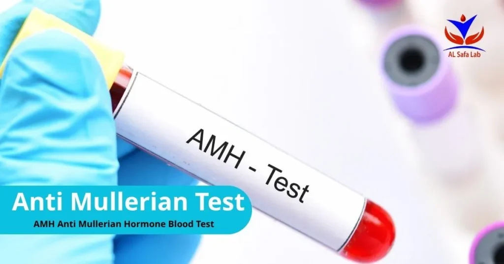 Anti Mullerian Test (AMH)