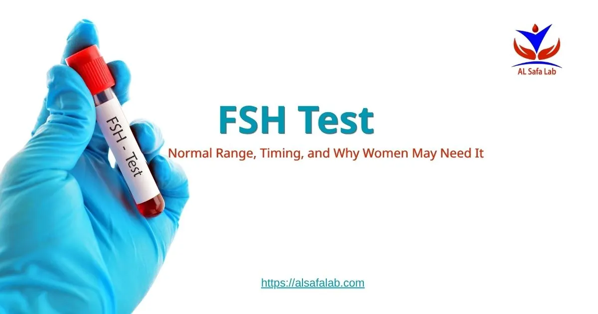 FSH Test