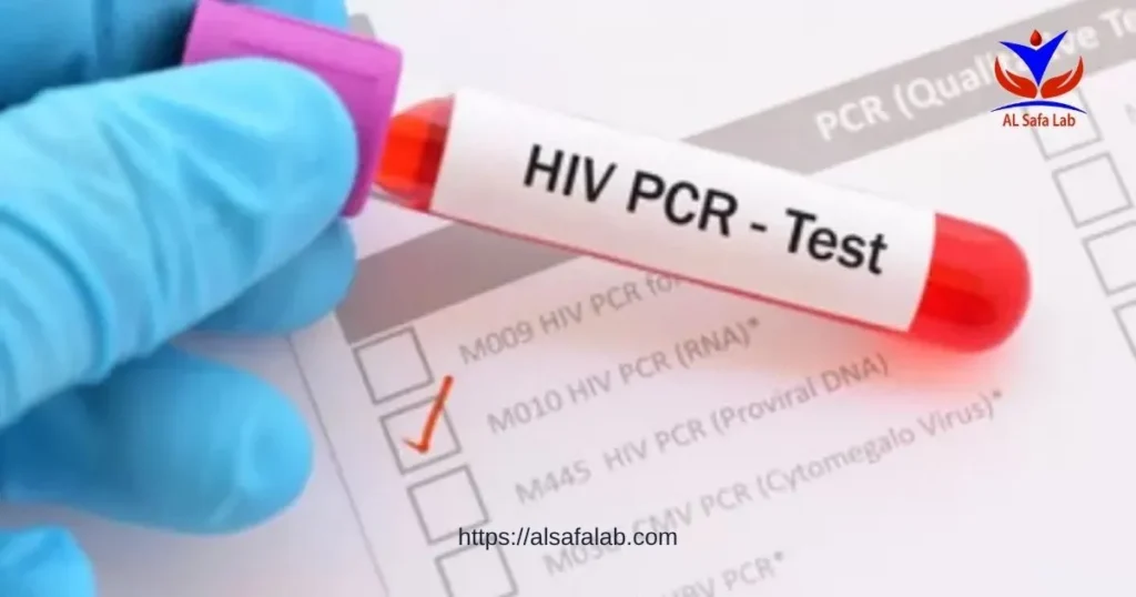 HIV PCR Test