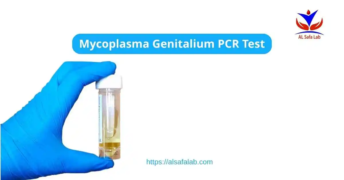 Mycoplasma Genitalium PCR