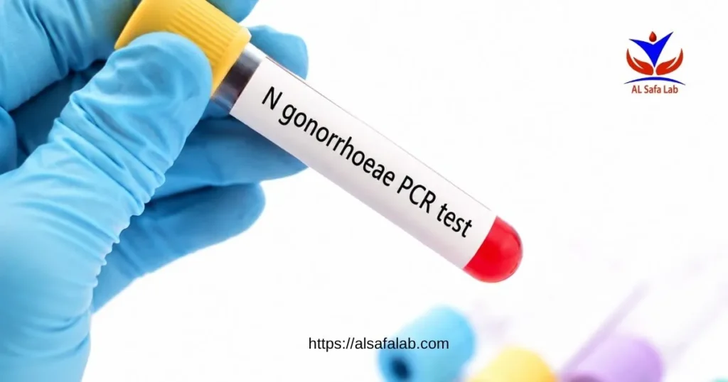 N gonorrhoeae PCR