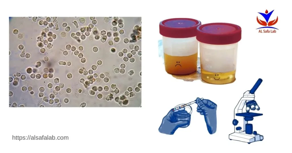 std panel pcr urine