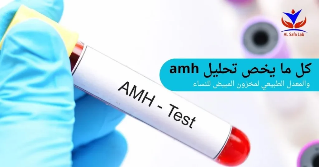 تحليل AMH