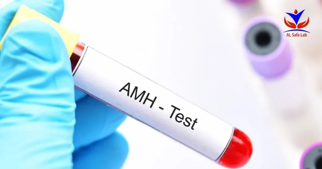 تحليل AMH 